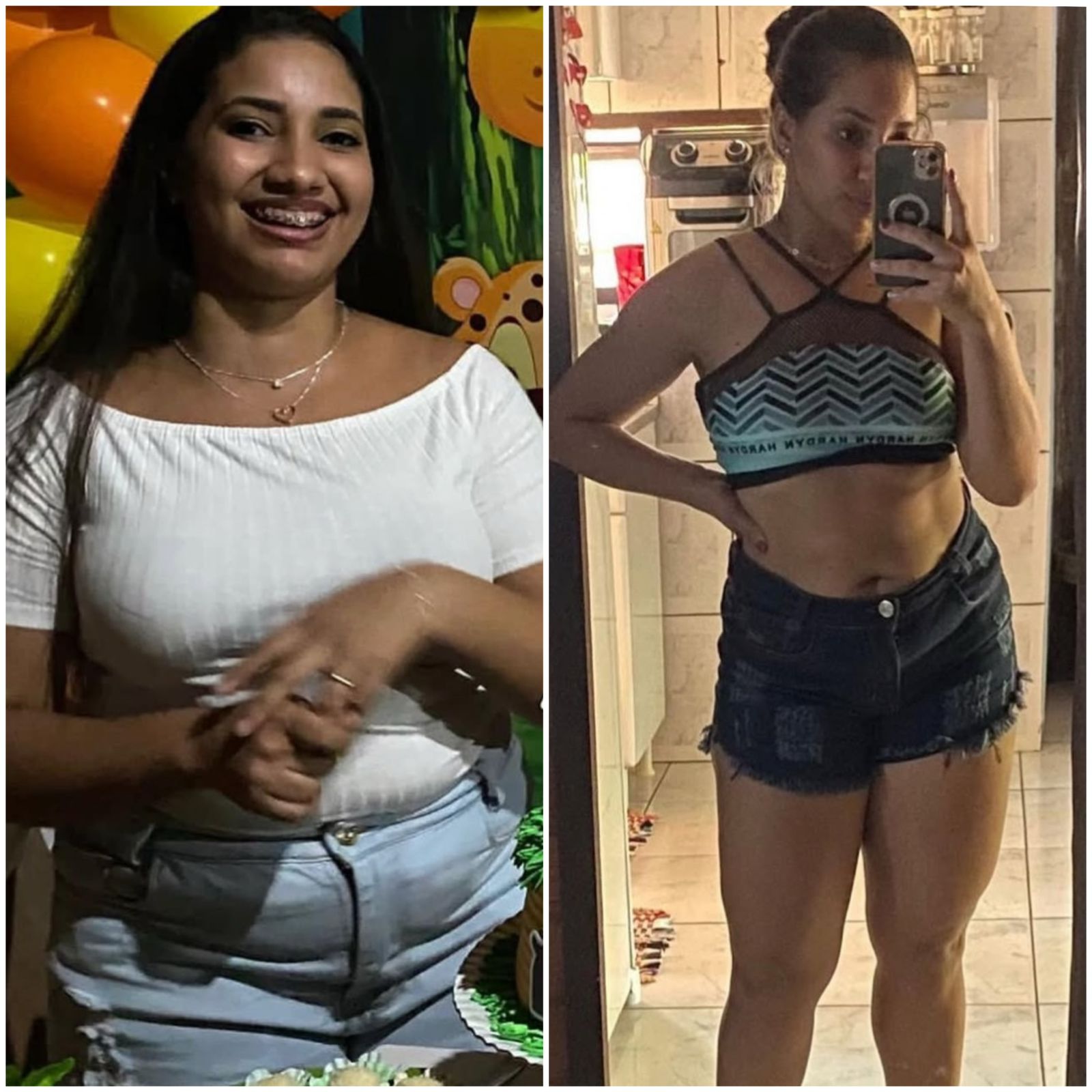 obesidade22