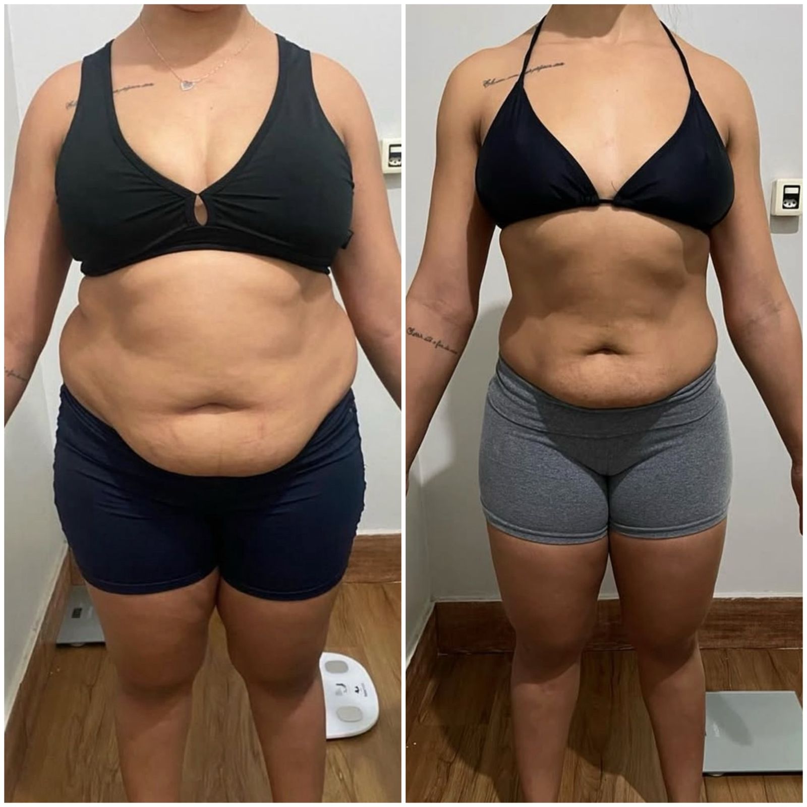 obesidade23