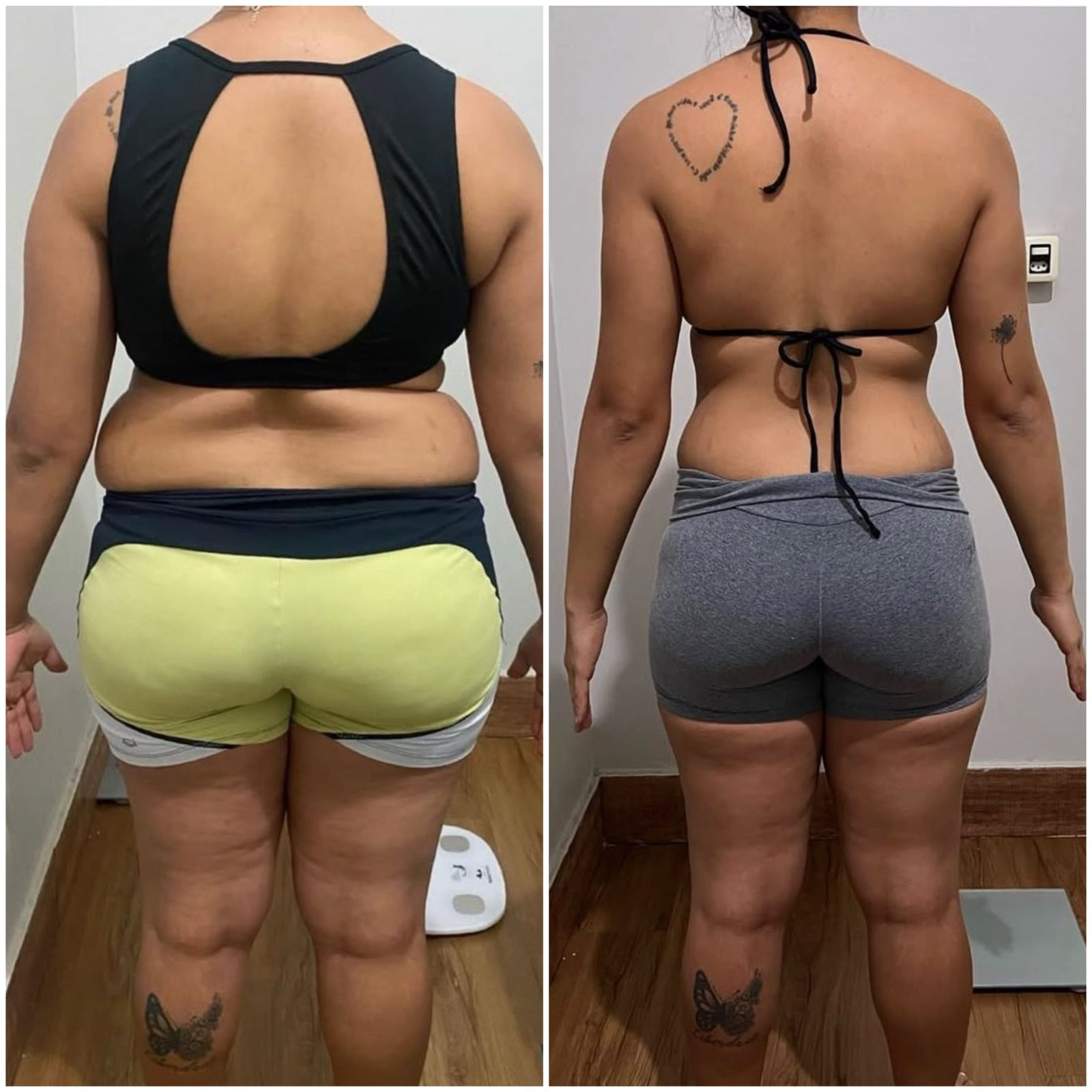 obesidade25