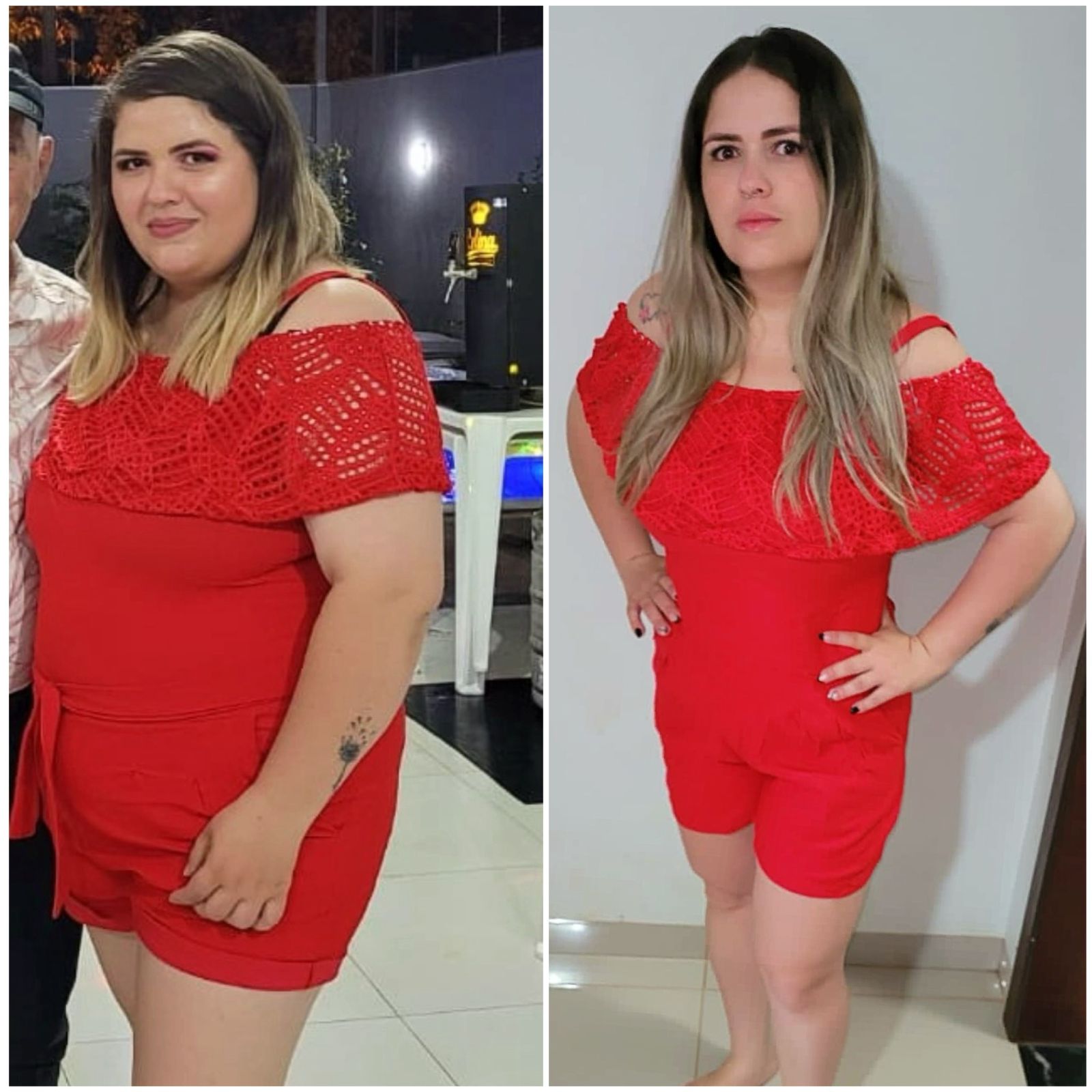 obesidade29