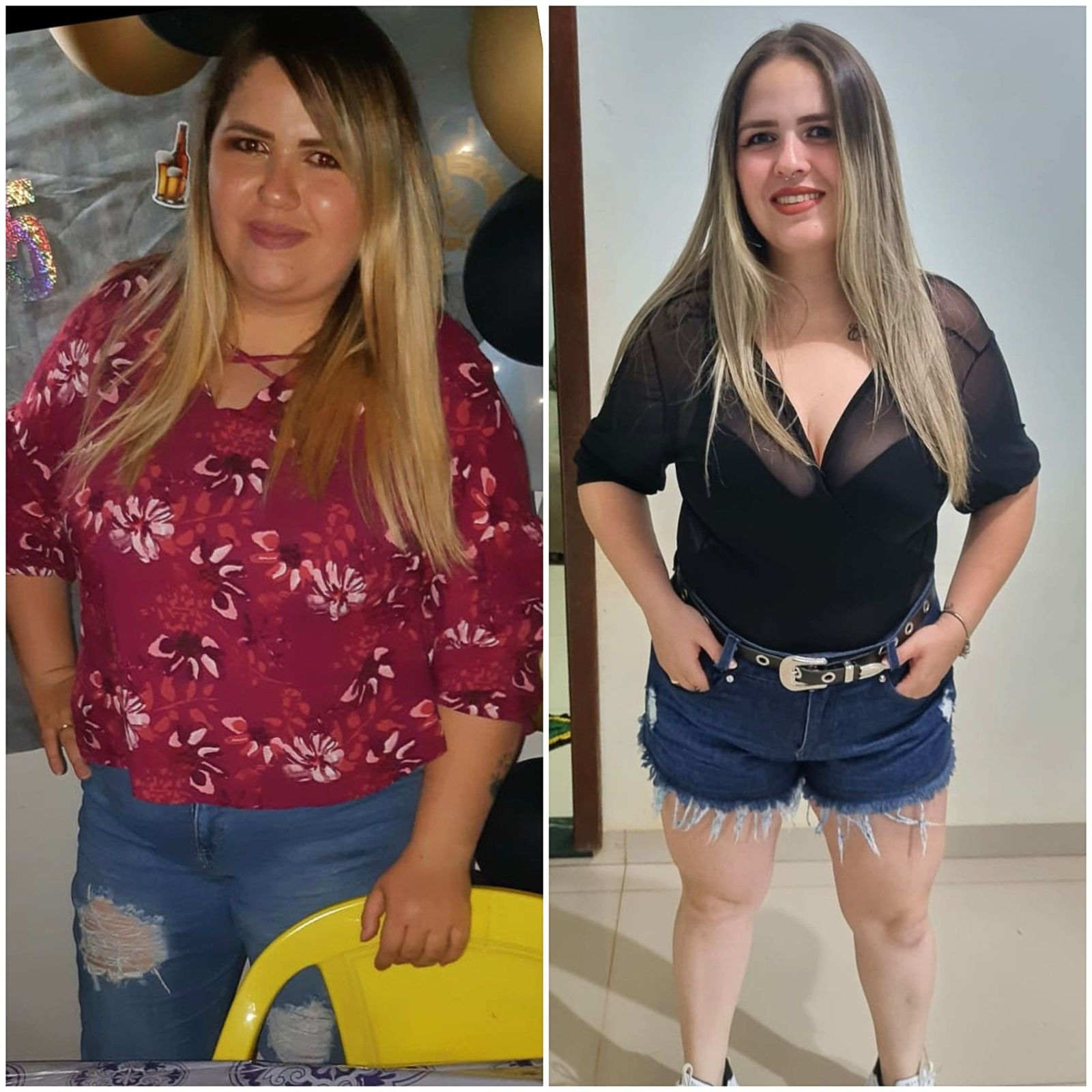 obesidade30