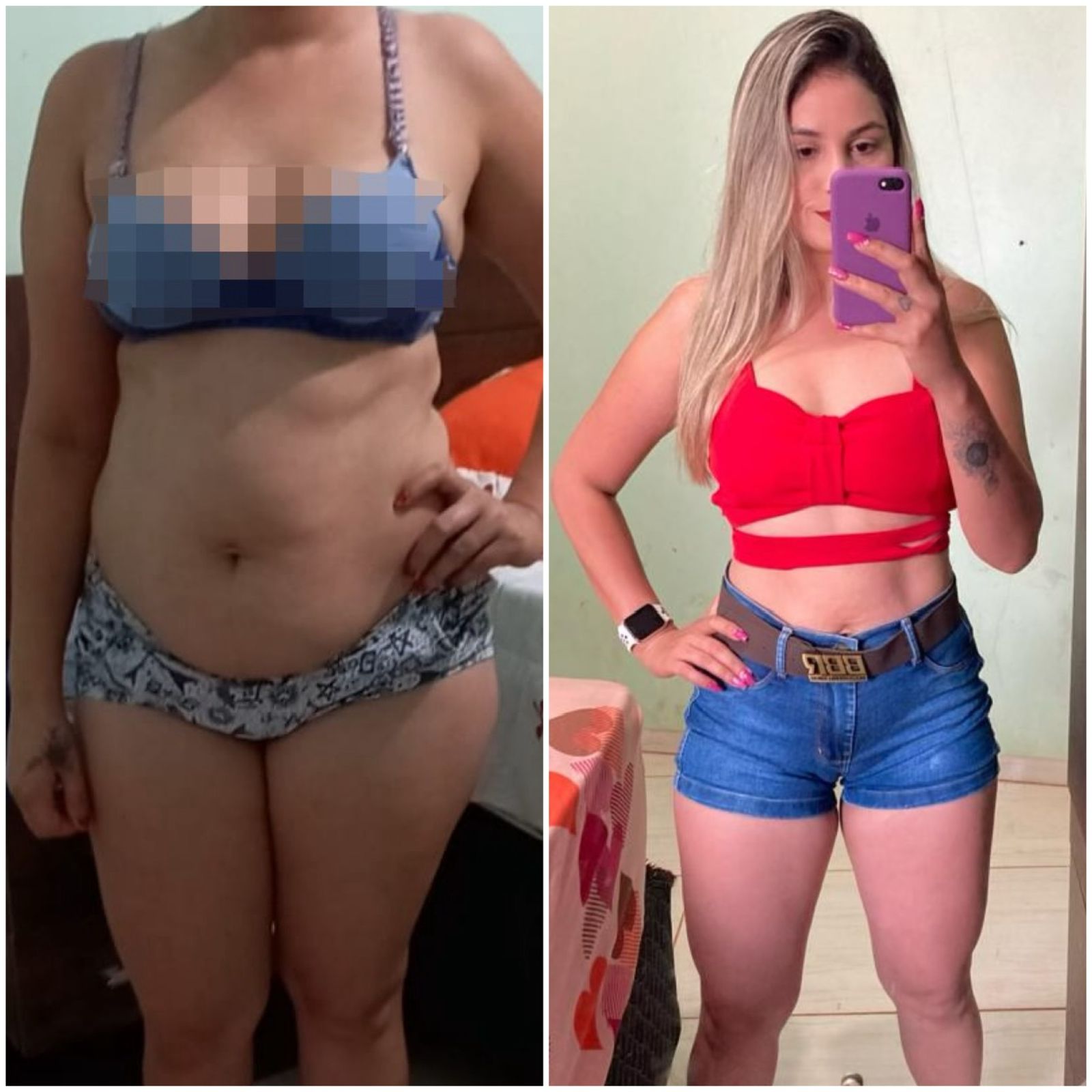 obesidade31