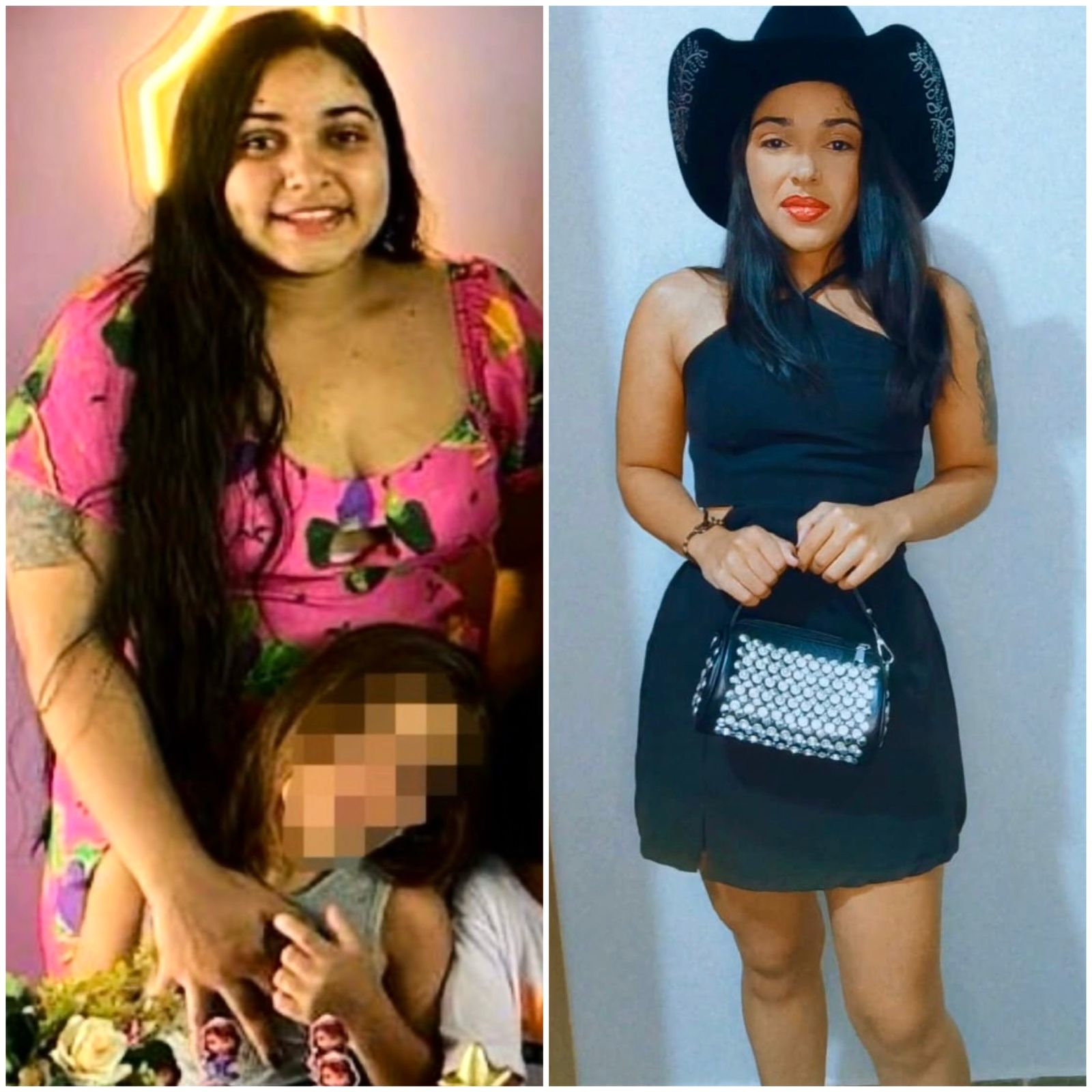 obesidade38
