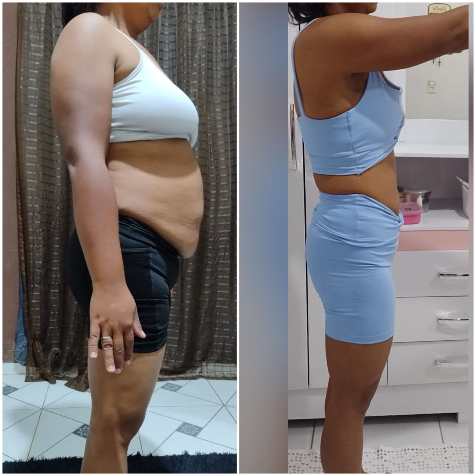 obesidade4