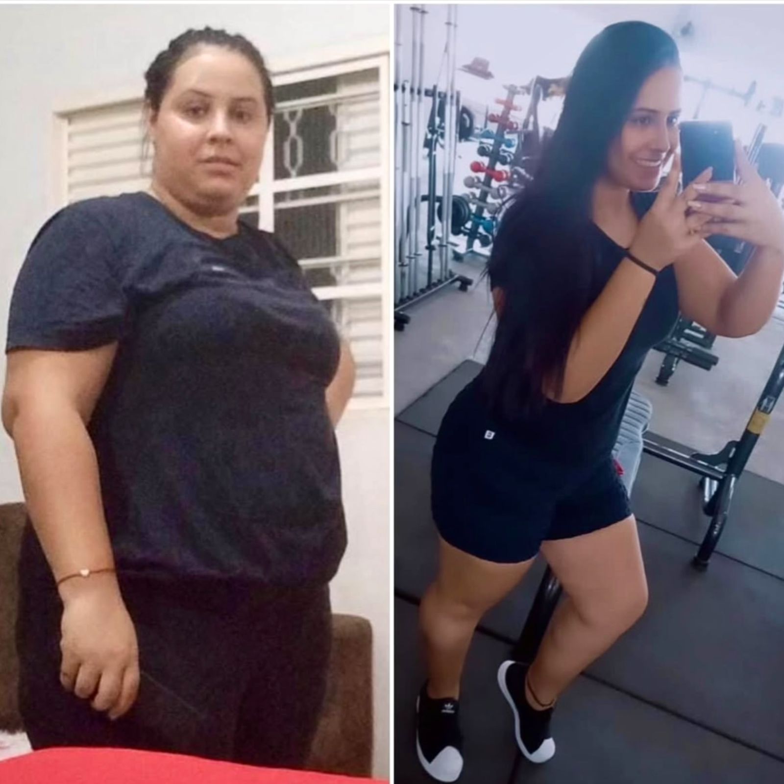 obesidade42