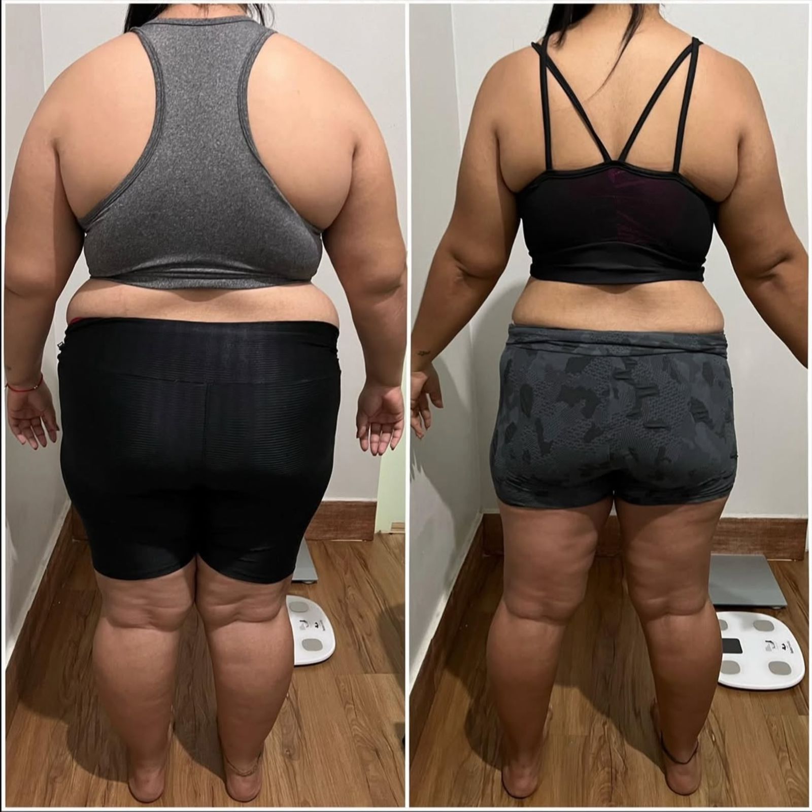 obesidade45
