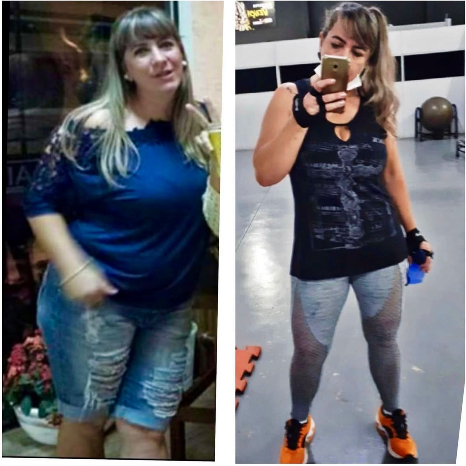 obesidade46