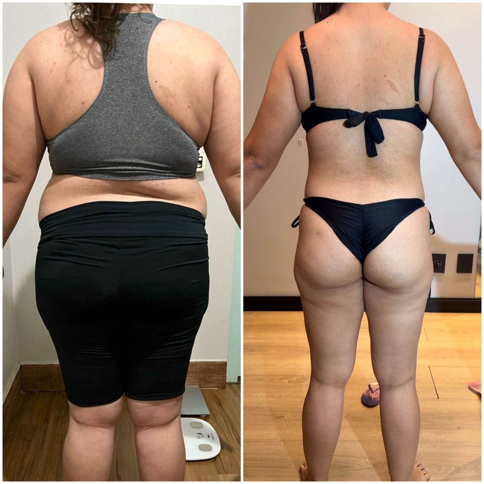 obesidade50