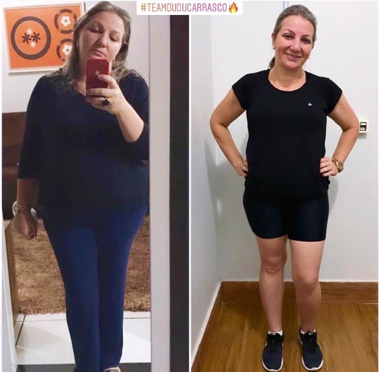 obesidade51