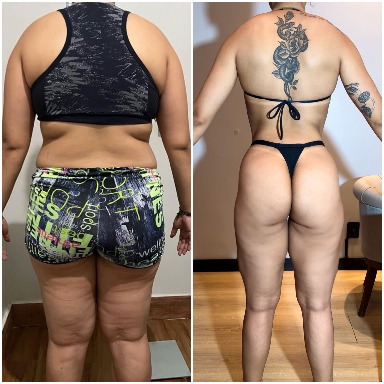 obesidade9