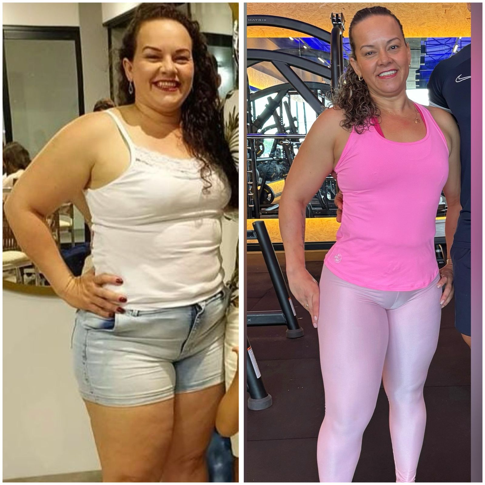 obesidade62