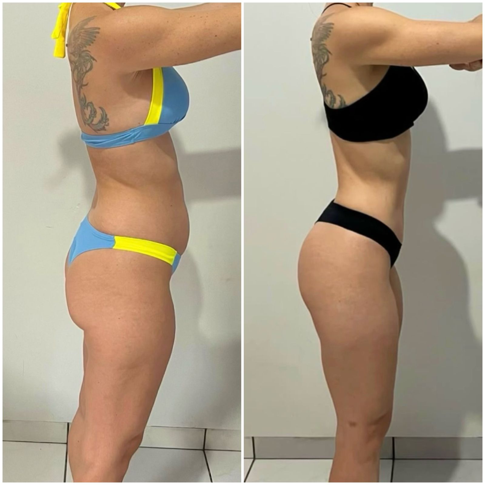 posgestacao83